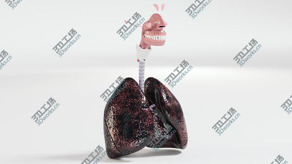 images/goods_img/20210312/3D Respiratory System Smoker's Lungs heavy stage/1.jpg
